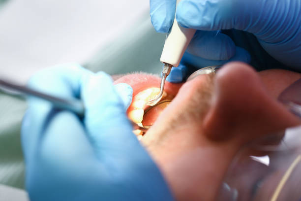Best Pediatric Emergency Dentist in Reliez Valley, CA