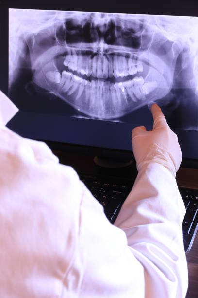Best Weekend Emergency Dentist in Reliez Valley, CA